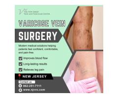Varicose Vein Surgery in NJ