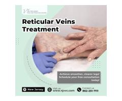 Reticular Veins Treatment in NJ