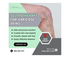 Sclerotherapy for Varicose Veins in NJ