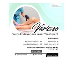 Varicose Veins Endovenous Laser Treatment in NJ