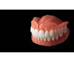 Immediate Dentures in Mount Roskill