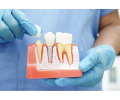 Dental Crowns in Mount Roskill, Auckland