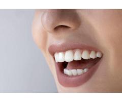 Tooth Color Fillings in Mount Roskill