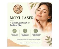 Glow Skin Moxi Laser Fort Worth, TX | Hidden Door Spa