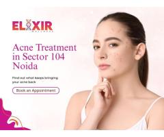 Skin Treatment in Sector 104, Noida | Skin Clinic