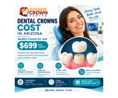 Dental Crowns Cost in Arizona – Quality Crowns for Just $699