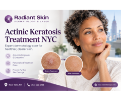 Are You Looking for Actinic Keratosis Treatment NYC?
