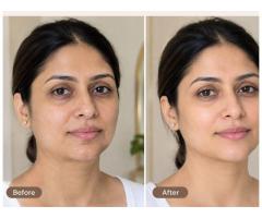 Best Laser Skin Tightening Treatments in Amritsar for Firm Skin