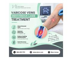 Varicose Veins Endovenous Laser Treatment in NJ